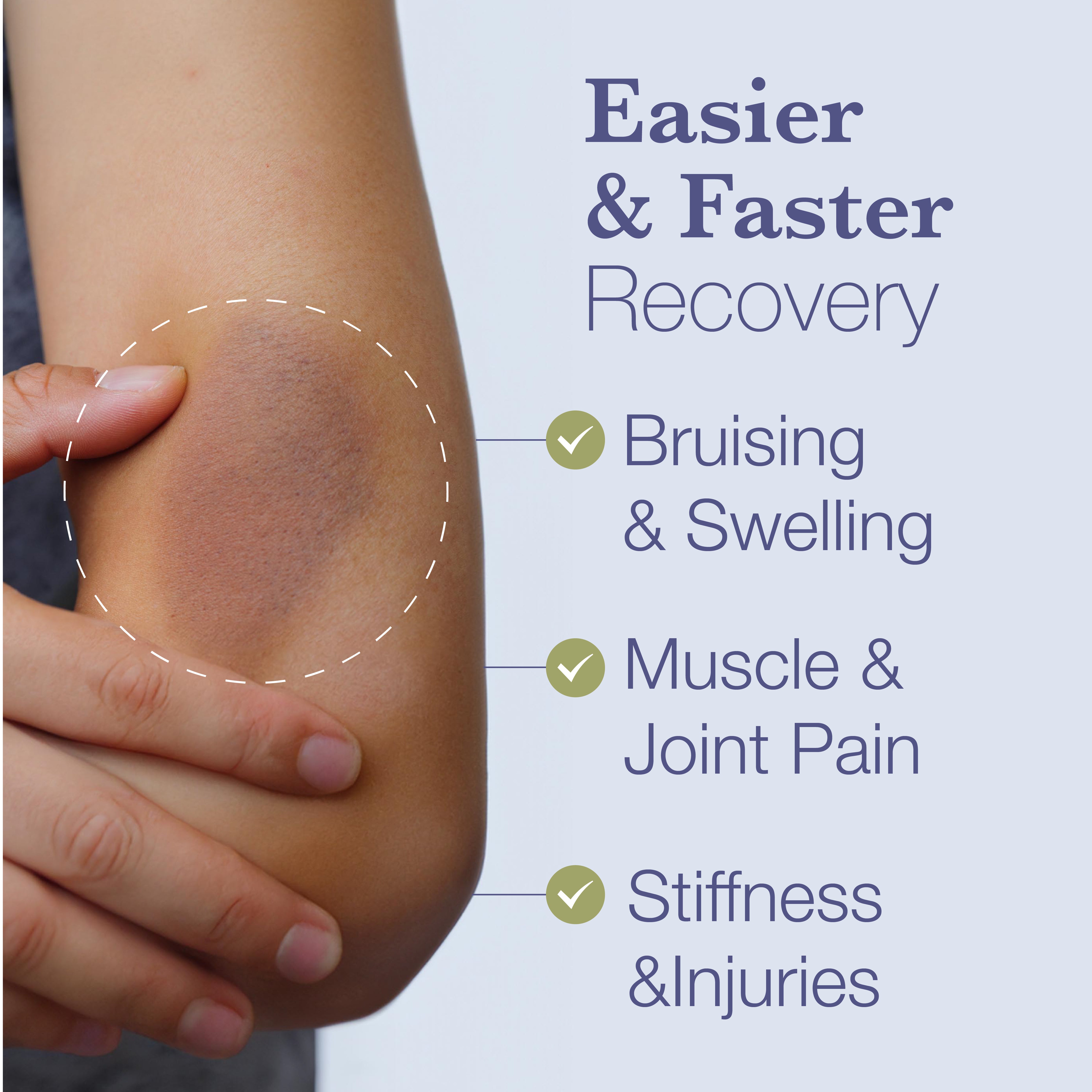 BruiseMD Topical Bruise Gel With Arnica and Caffeine